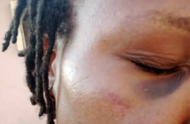 DOMESTIC VIOLENCE: My Husband Threatens To Kill Me,Woman Cries Out In Ondo