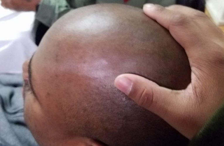 Ritualists Now Target Bald Men, Believe Their Heads Contain Gold