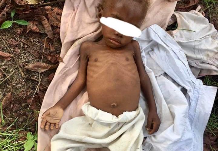 Aid Worker Rescues Abandoned Toddler Accused Of Witchcraft